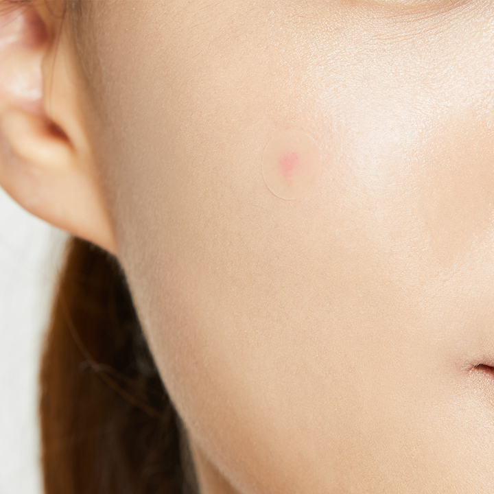 COSRX - 24 Parches contra Acné - Pimple Master Patch | Knatural